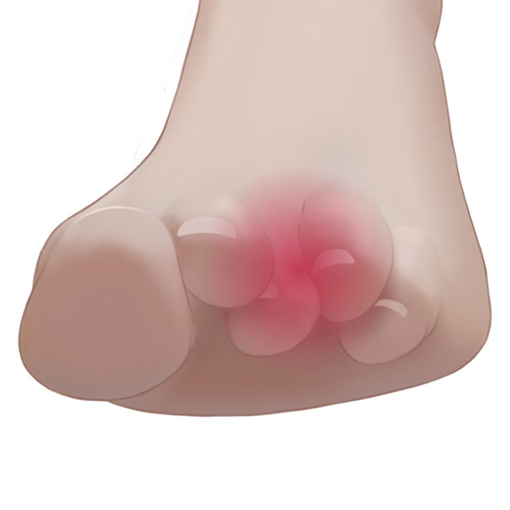 Δακτύλιος ευθυγράμμισης μεσαίου δαχτύλου 07-2-059 Vita