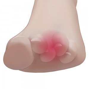 Δακτύλιος ευθυγράμμισης μεσαίου δαχτύλου 07-2-059 Vita