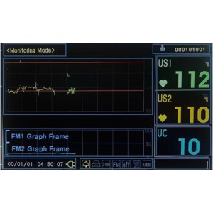 ΚΑΡΔΙΟΤΟΚΟΓΡΑΦΟΣ ECOtwin LCD with USB (2nd Gen.)
